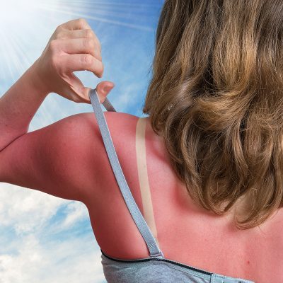 Image for The best life hack? Wear sunscreen.