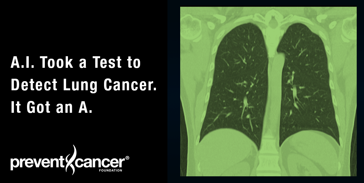 A.I. Took a Test to Detect Lung Cancer. It Got an A.