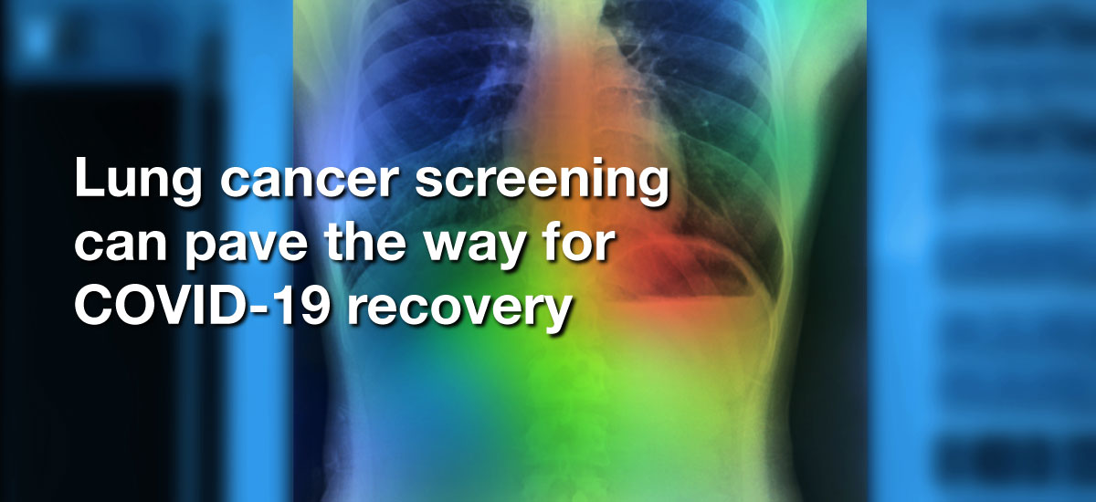 Lung cancer screening can pave the way for COVID-19 recovery